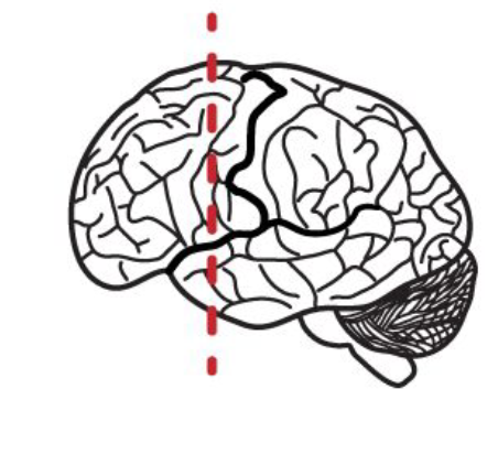 <p>What anatomical plane is this?</p>