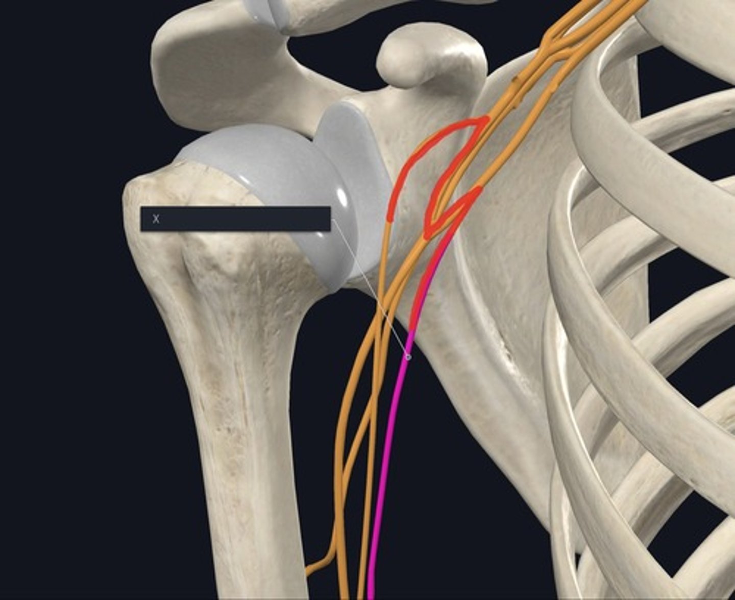 <p>Name the nerve highlighted purple and indicated by the X.</p>