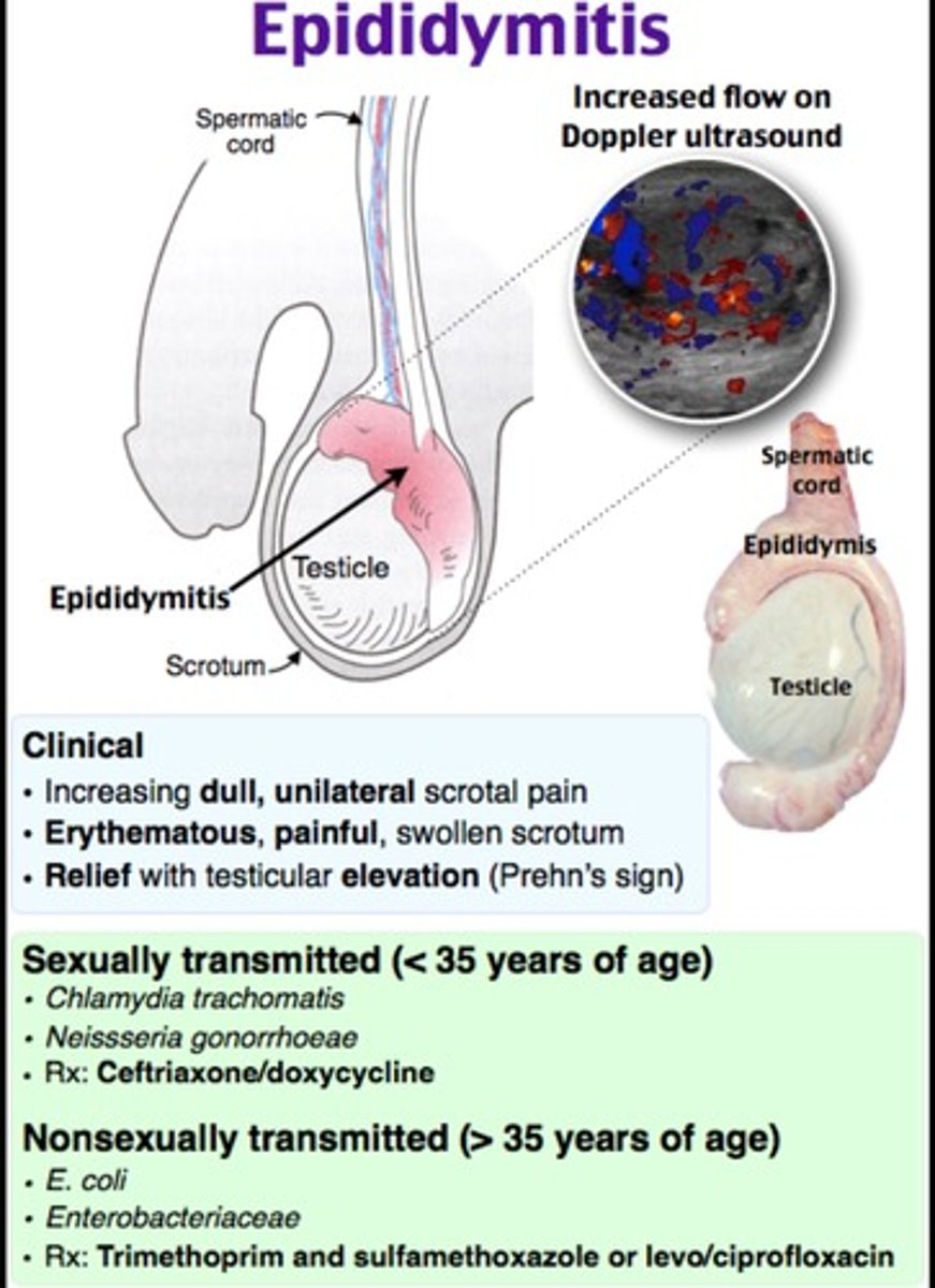 <p>Inflammation of the epididymis, often painful.</p>