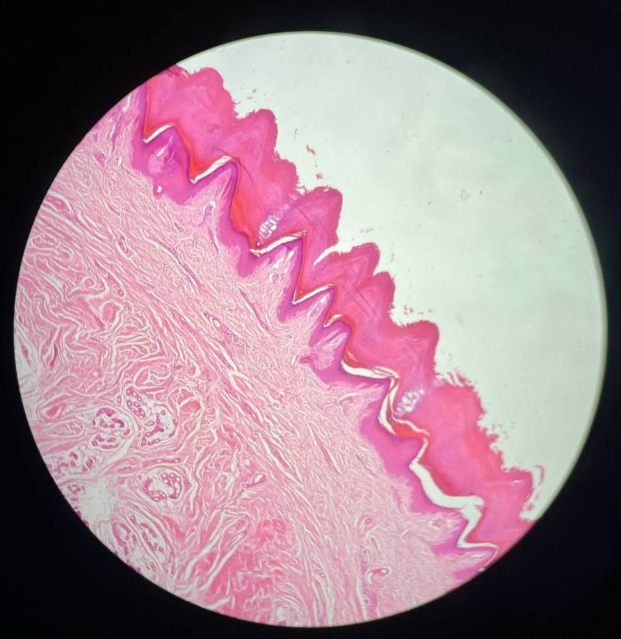 <p>Identify the tissue and mention one site</p>