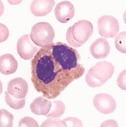 <p><span style="font-family: "Times New Roman", serif">Bilobed nucleus; involved in allergic reactions and parasitic infections. Contain granules with cytotoxic proteins.</span></p>
