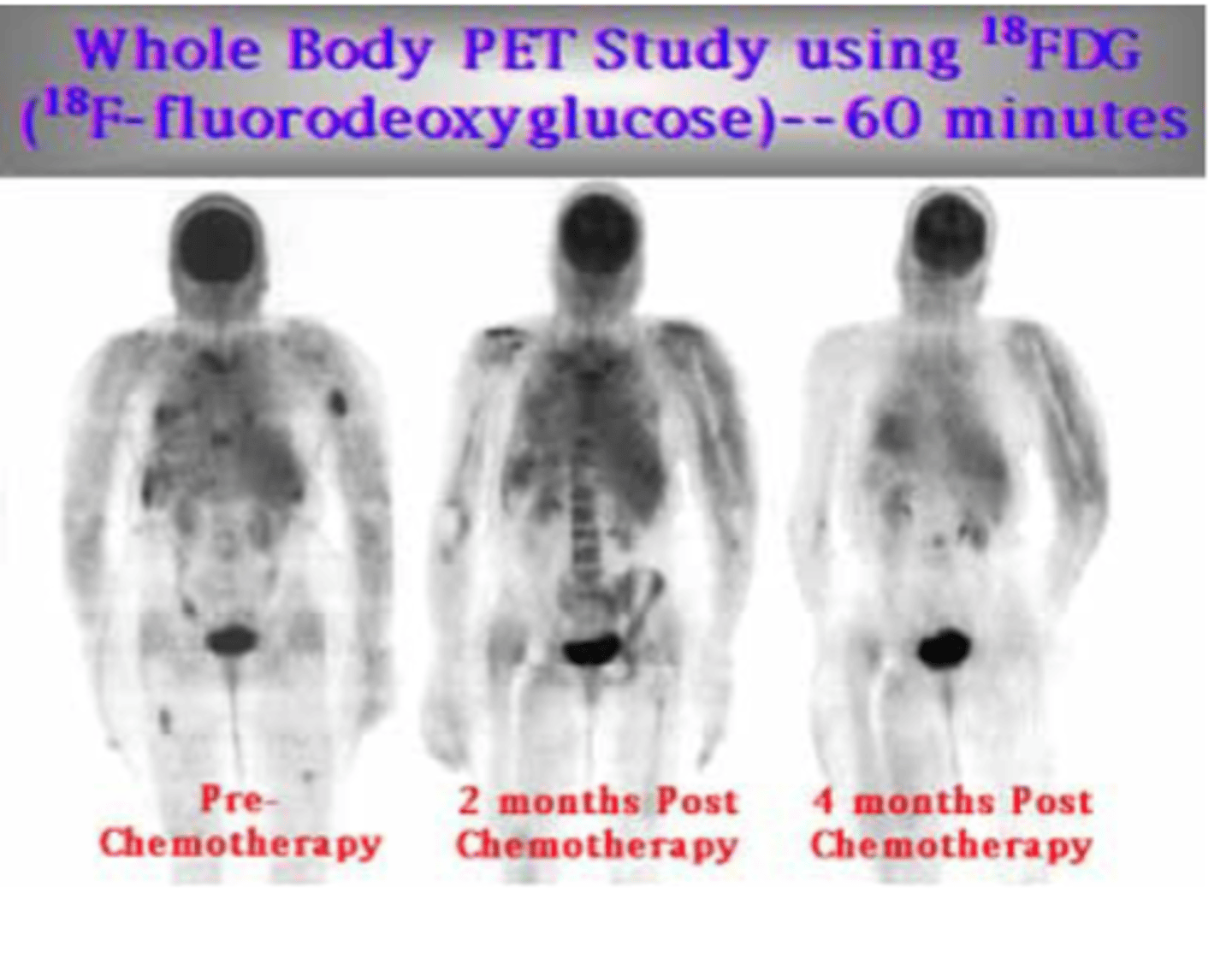 <p>Blood flow, oxygen levels, and glucose metabolism.</p>