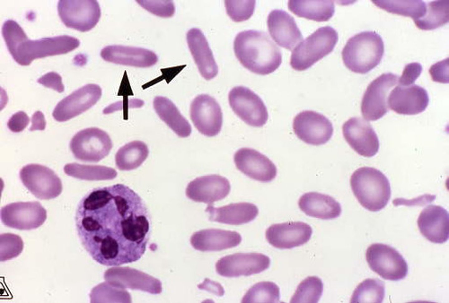 <p>cigar cell</p>