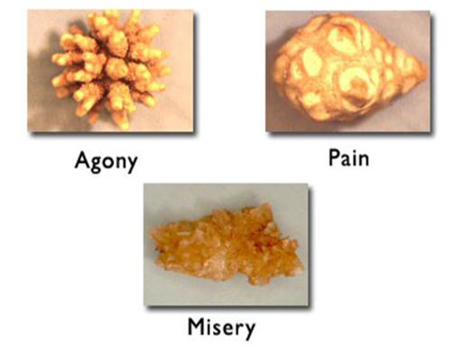 <p><span>Urinary Tract Calculi: Diagnostics &amp; Interprofessional care</span></p>