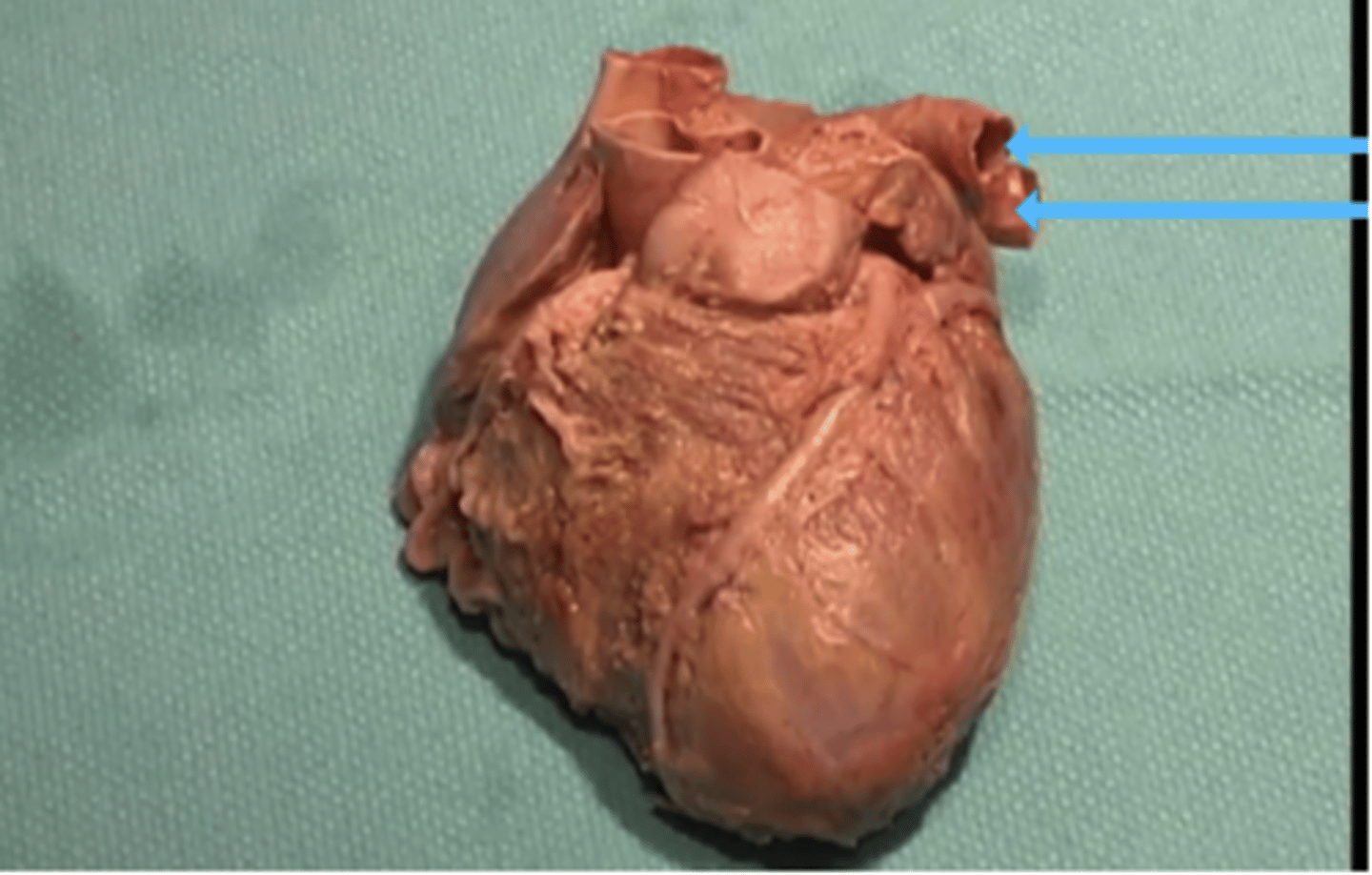 <p>To what structures are the arrows pointing?</p><p>aorta</p><p>right atria</p><p>inferior vena cava</p><p>pulmonary veins</p>