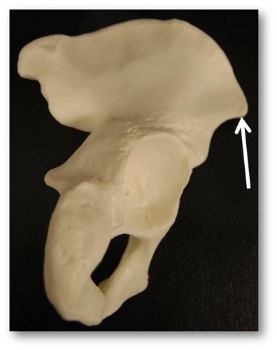 Name this specific part of the pelvic bone.