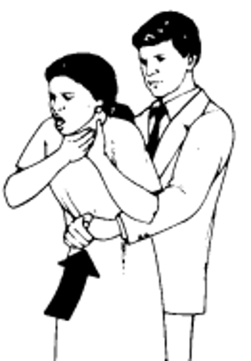 <p>the act of applying pressure to a choking person's stomach to force an object out of the throat</p>