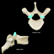 Name this specific part of the thoracic vertebra.