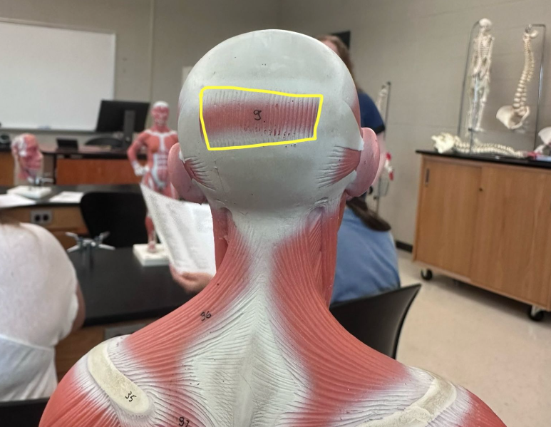 <p>What muscle is the yellow line indicating?</p>