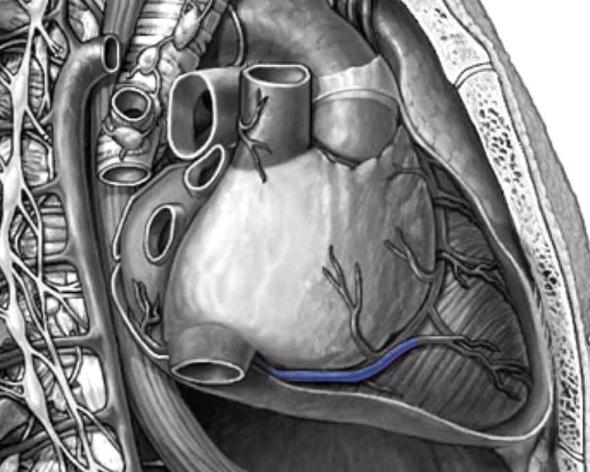 <p>Which heart circulation:</p><ul><li><p>Parallels right marginal artery</p></li></ul><p></p>