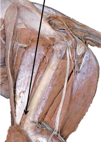 <p>Origen e Inserción del Articular de la Patela<br>(Solo Ru y Car)</p>