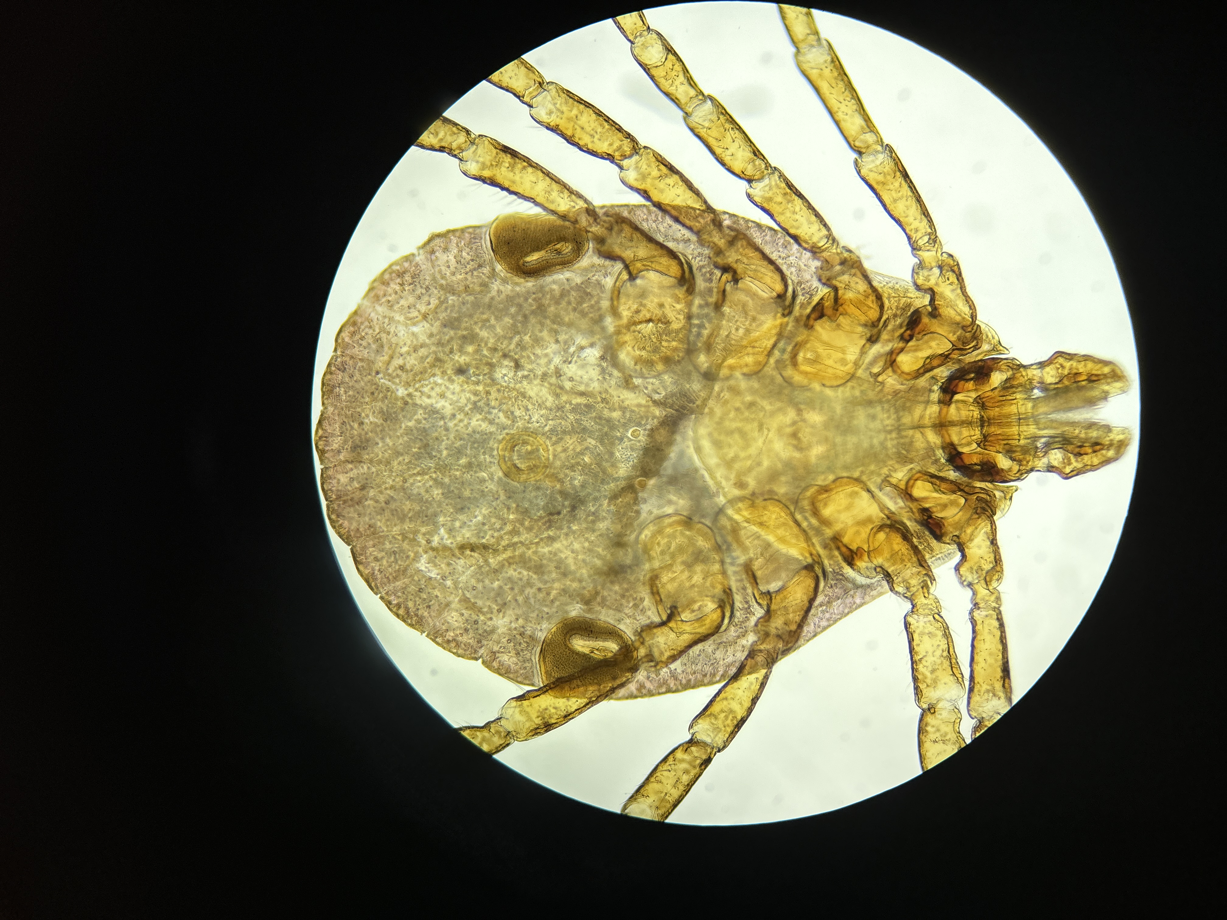 <p>Identify this Tick. (Common &amp; Genus)</p>