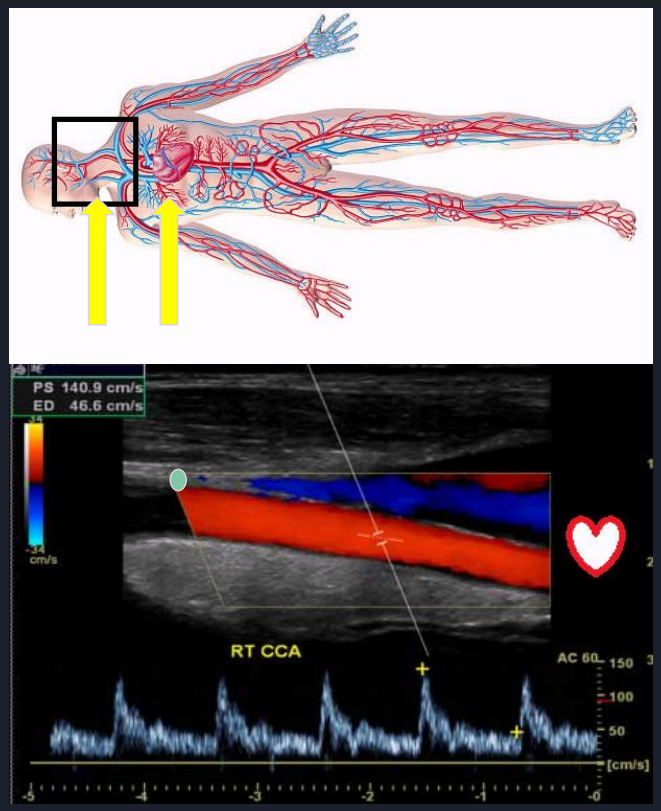 <p>describe the blood flow occurring in this image</p>