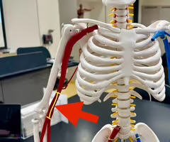 <p>Name the blood vessel.</p>