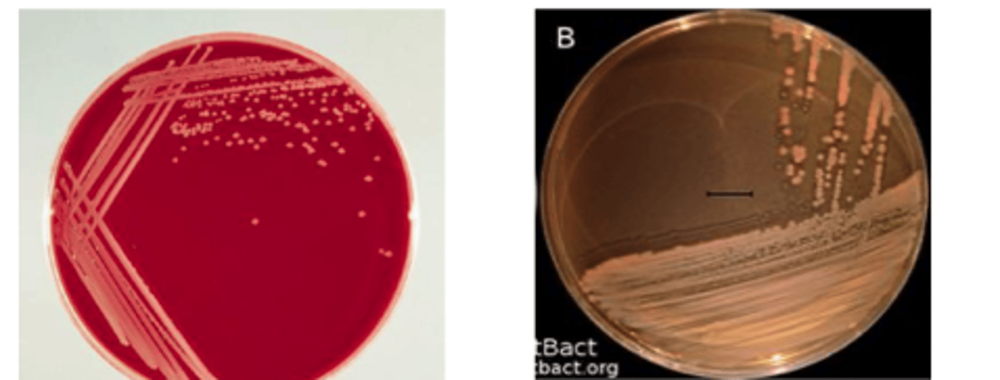 <p>A one-year-old male Labrador retriever presented with mild depression and recent history of a harsh, dry "honking" cough that appears to be exercise-related. The dog has a mild fever and palpation of the trachea elicited the cough. Further questioning of the owners revealed that their dog had been in a boarding kennel two weeks prior to becoming ill. BA and MAC cultures from an oropharyngeal swab are provided. Examine the prepared</p><p>Gram stain. The isolate is oxidase-positive. Describe the colonial morphology. Use the history and culture results to determine a presumptive identification and disease</p><p>diagnosis.</p>