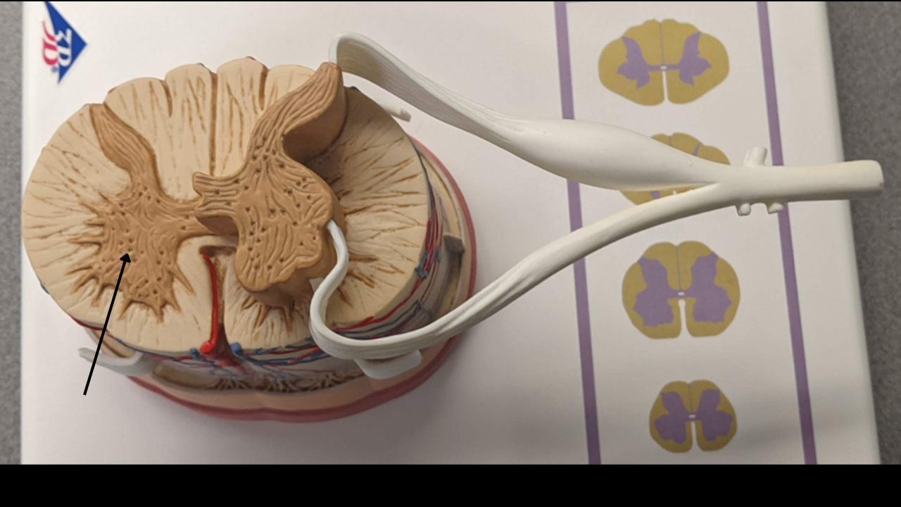 <p>(2) Grey Matter </p>