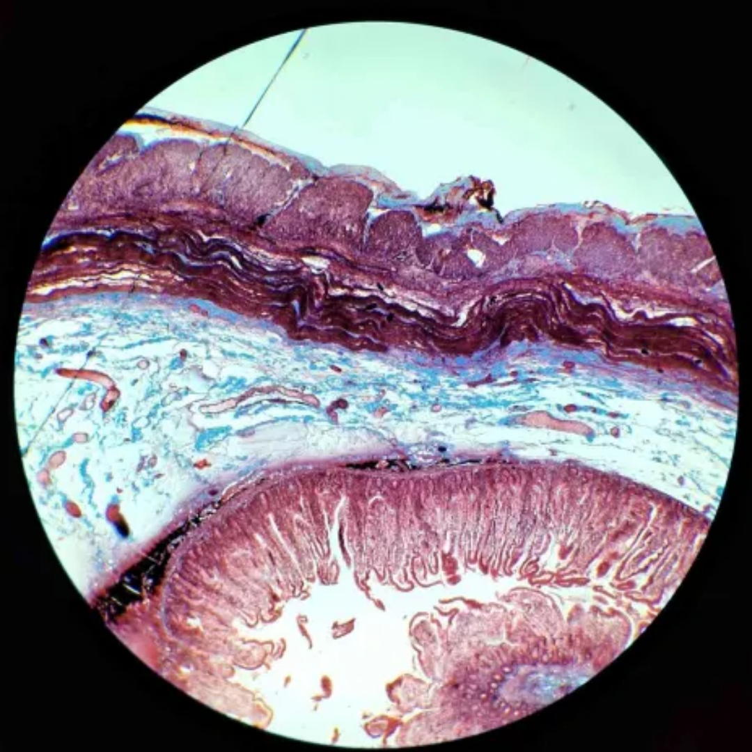 term image