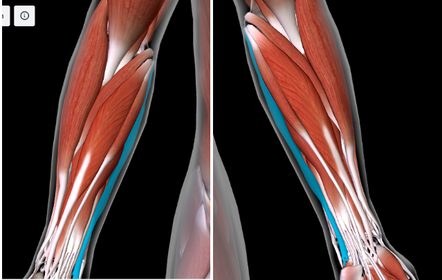 <p>Function: <strong>ADDUCT and FLEX WRISTS</strong></p><p>Origin: MEDIAL EPICONDYLE OF HUMERUS; <strong>OLECRANON PROCESS OF ULNA </strong></p><p>Insertion: <strong>CARPAL BONES; 5TH METACARPAL </strong></p><ul><li><p>MOST MEDIAL from the brachioradialis (this is 4th AWAY from the brachioradialis)</p></li></ul><p></p>