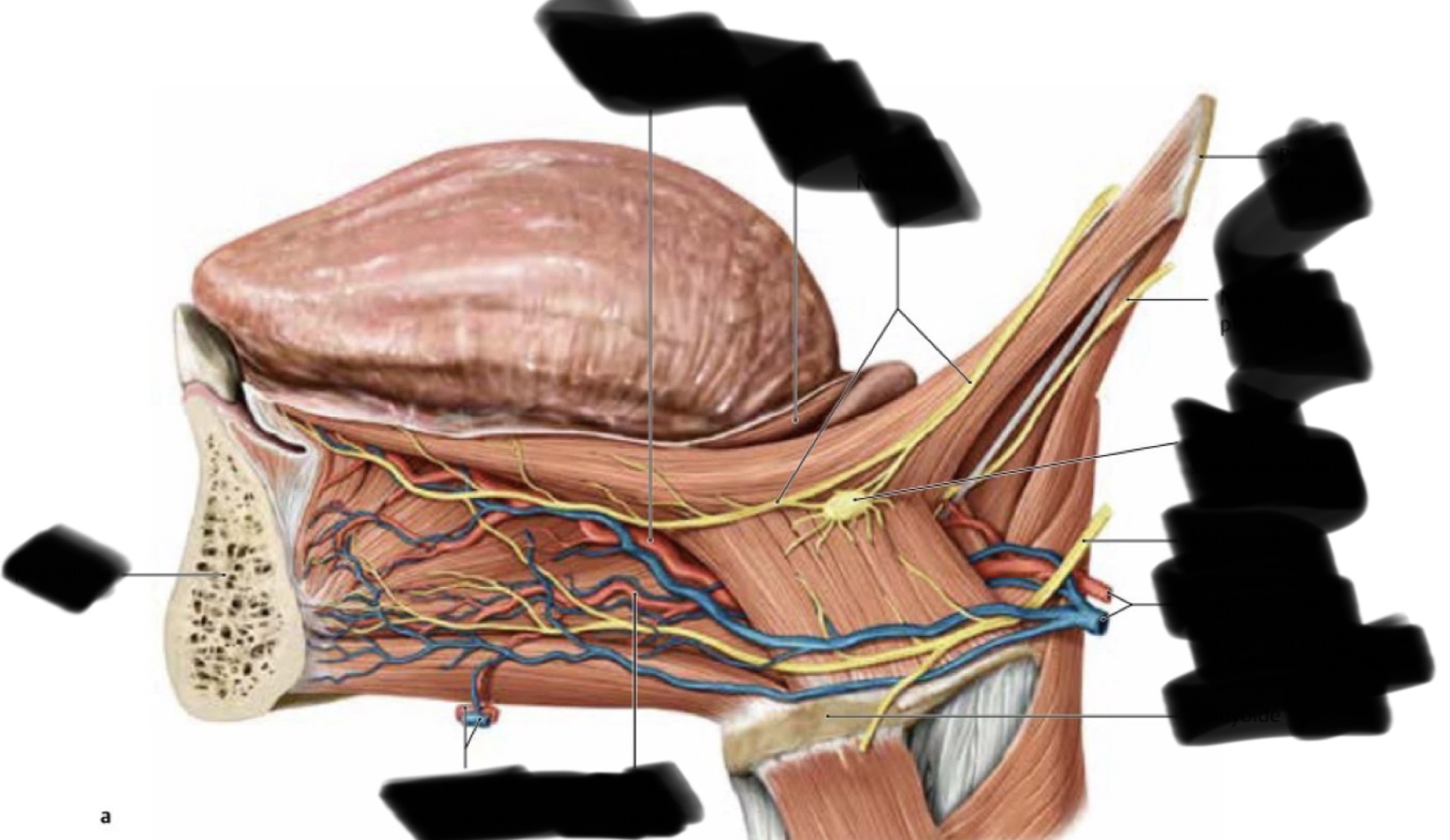 <p>Quels sont les deux nerfs passant en dehors du muscle hyo-glosse ? (image)</p>