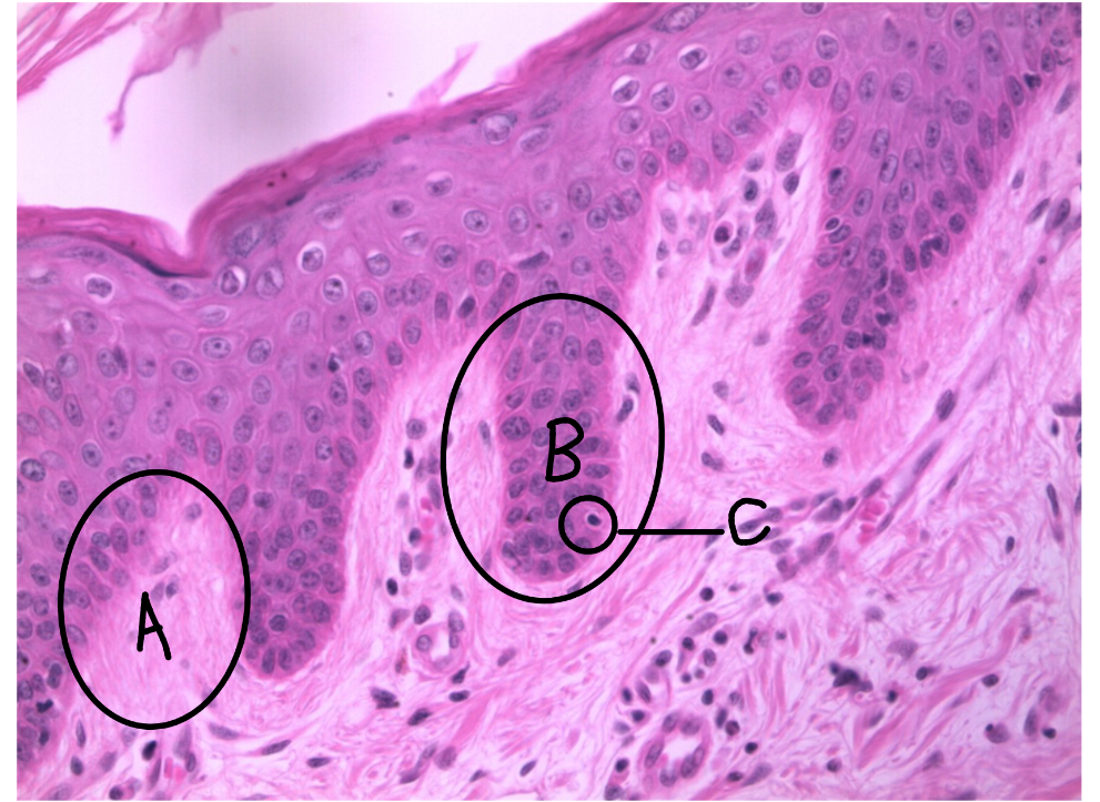<p>What is this a picture of? Identify the highlighted structures and describe them.</p>