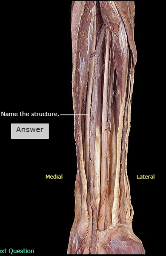 <p>What nerve is this</p>