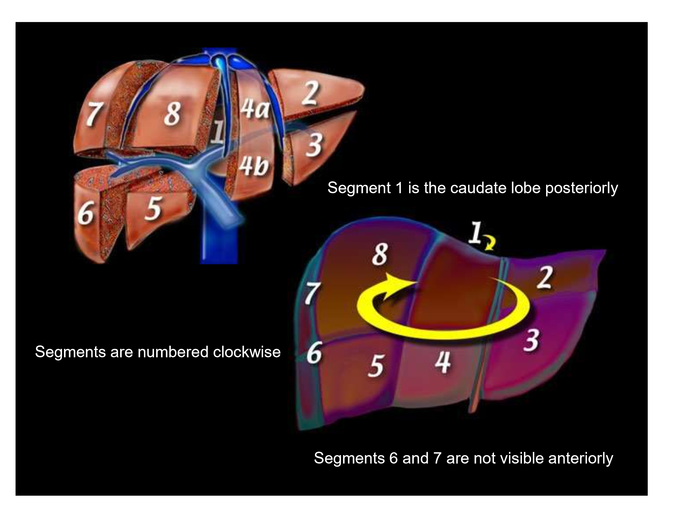 <p>the caudate lobe is located posteriorly on the liver. It is considered part of the left lobe. </p>