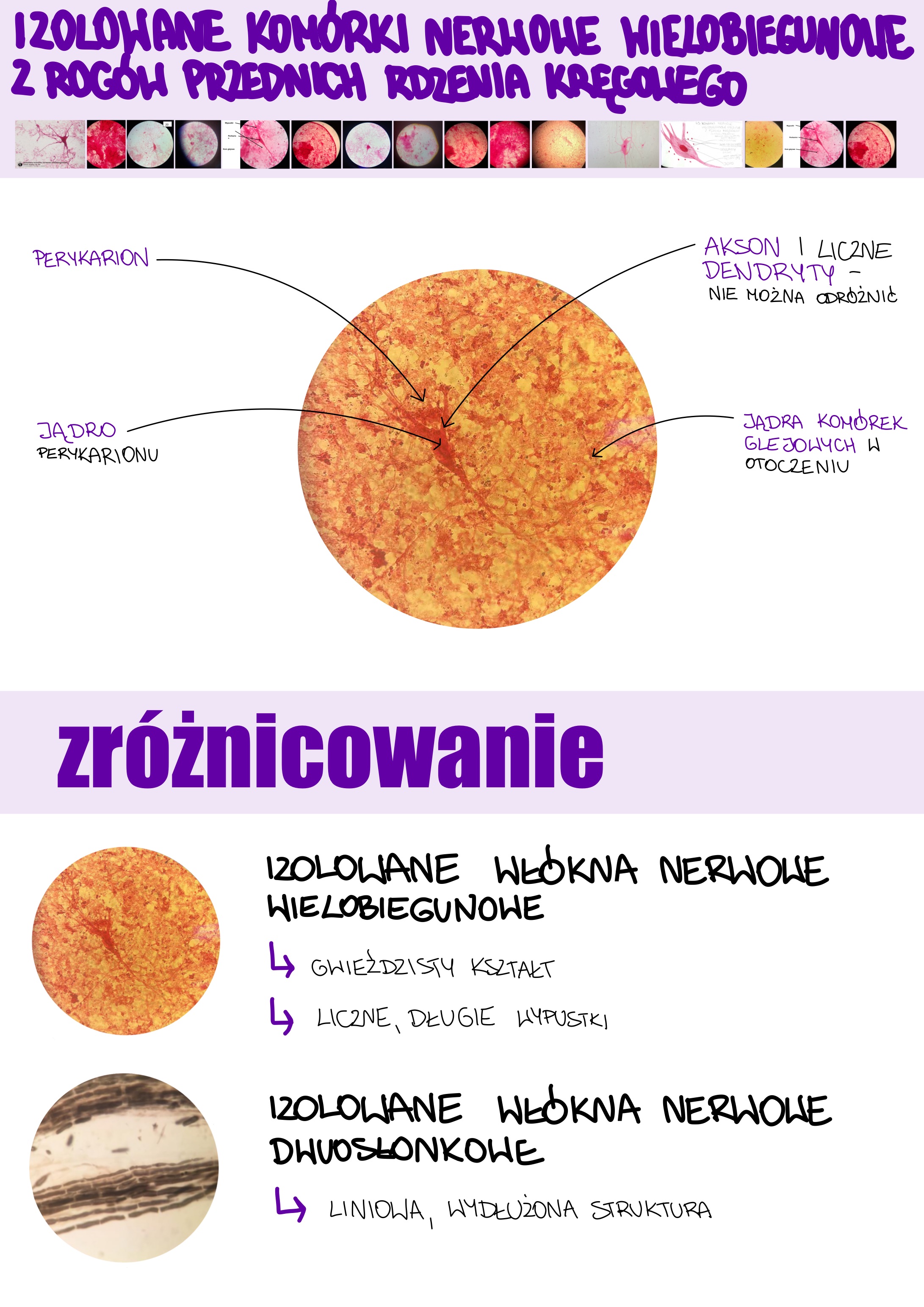 <p>Izolowane komórki nerwowe wielobiegunowe z rogów przednich rdzenia kręgowego</p>