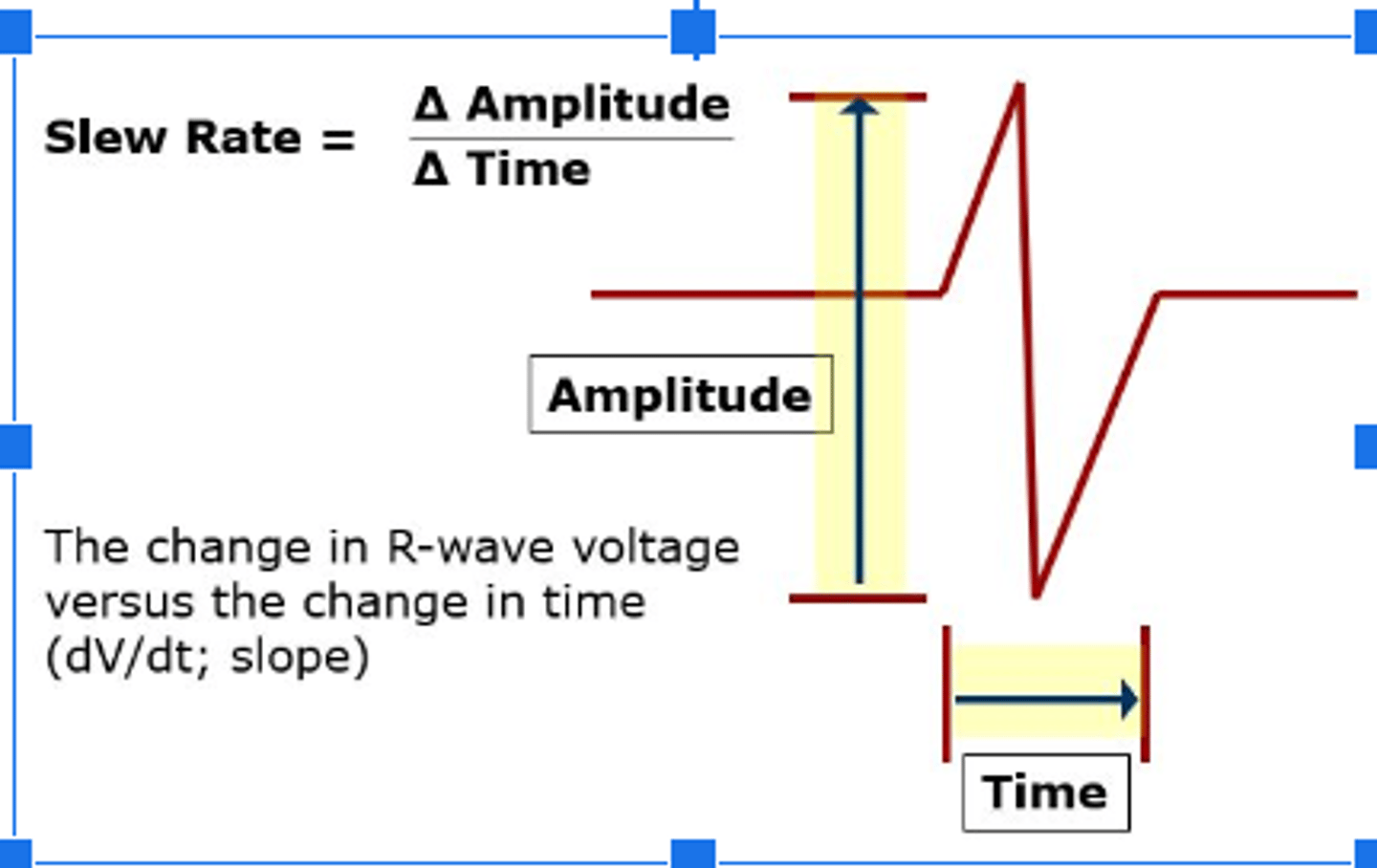 <p>the higher the frequency content and the more likely the signal will be sensed.</p><p>-T wave, are much less likely to be sensed because of a low slew rate and lower frequency density.</p>