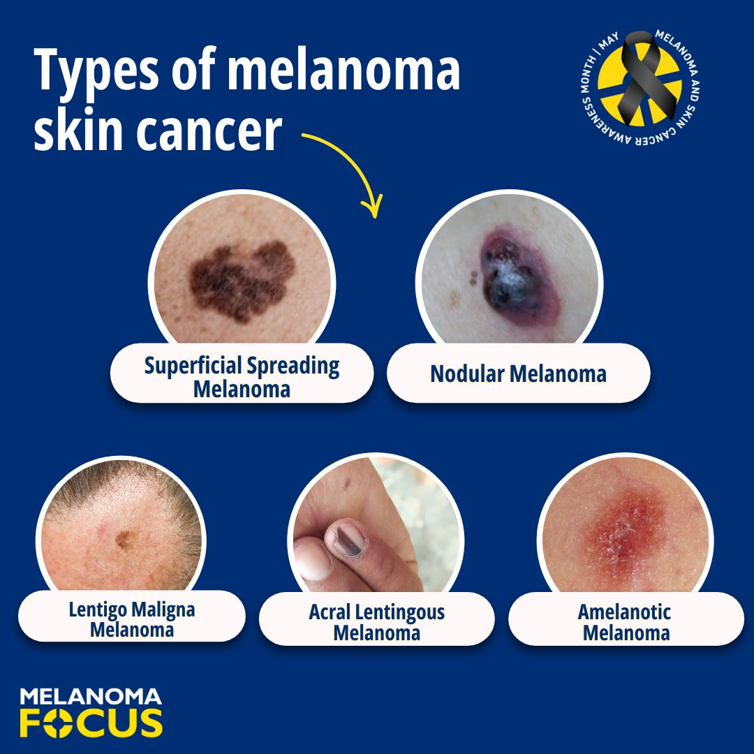 <p>describe the differences between: </p>