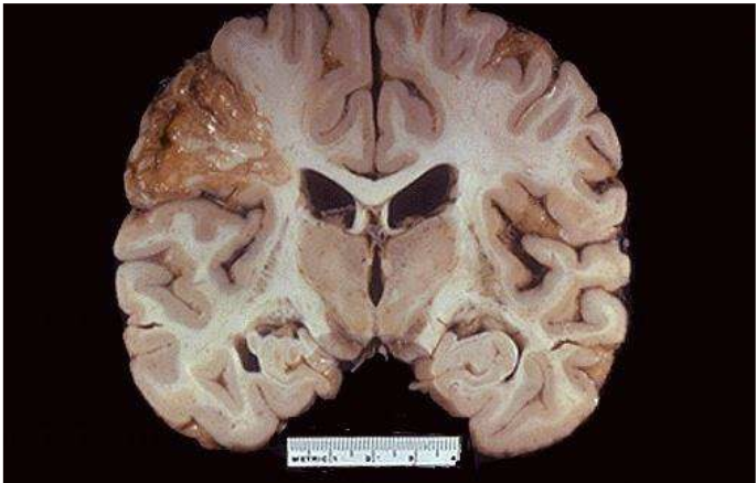 term image