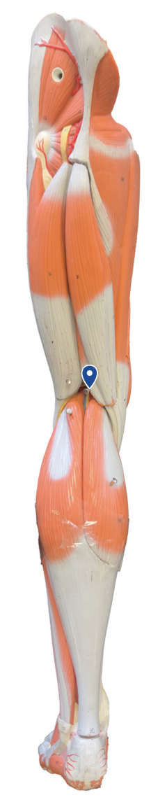 <p>What muscle is the arrow pointing to?</p>