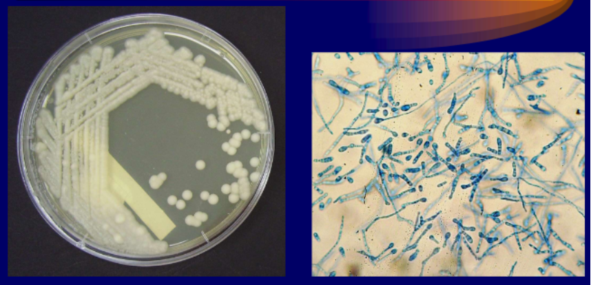 <p>Micro: Irregular shaped conidia</p><p>Macro: white powdery obverse, cream reverse</p>