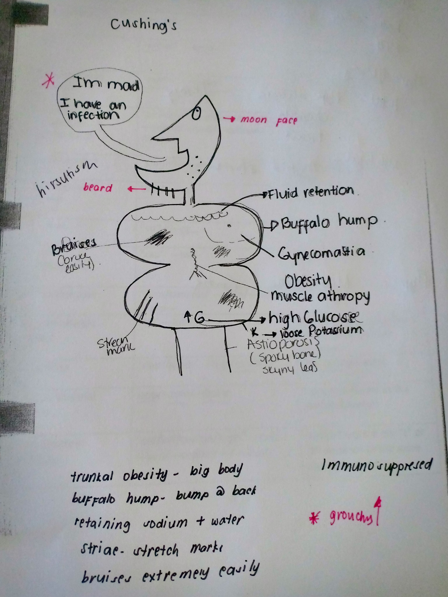 <p>addisons disease= adrenal insufficiency= hyperpigmented= not adapt to stress (go into hypoglycemic shock). Treatment= ADD- a- SONE/ steroid.</p><p></p><p>Cushings= adrenal oversecretion= cushy touchie= drawing of cushy man</p><p></p>