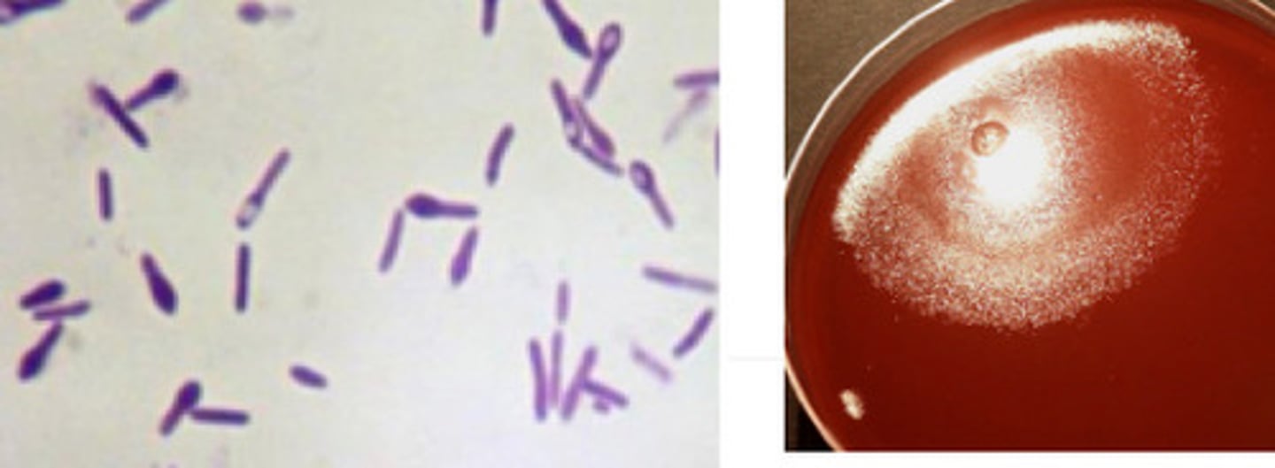 <p>GPB (easily discolourised , alpha or beat haemolytic, obligate anaerobe = sensitive to MTZ, cat neg, swarming, tennis racquet effect</p>