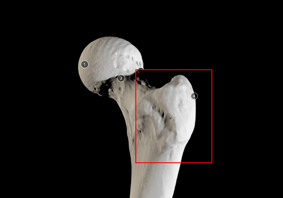 <p>greater trochanter - big tip size structure next to the neck of femur</p>