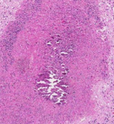 <p>What stain do you use to visualise calcification on a microscope slide?</p>