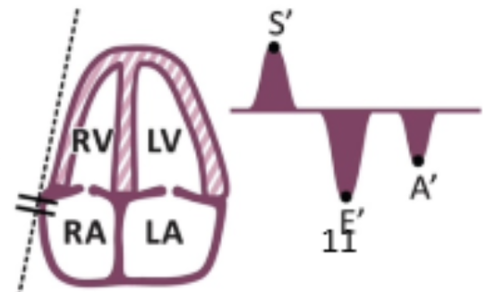 <ul><li><p>Measuring the <strong>speed</strong> of the tissue moving up and down</p></li><li><p> In AP4, place gate at the TV annulus or in the middle of basal segment to measure peak systolic <strong>velocity</strong></p></li></ul><p></p>