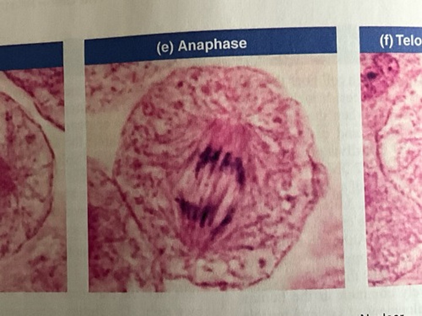 <p>Anaphase</p>