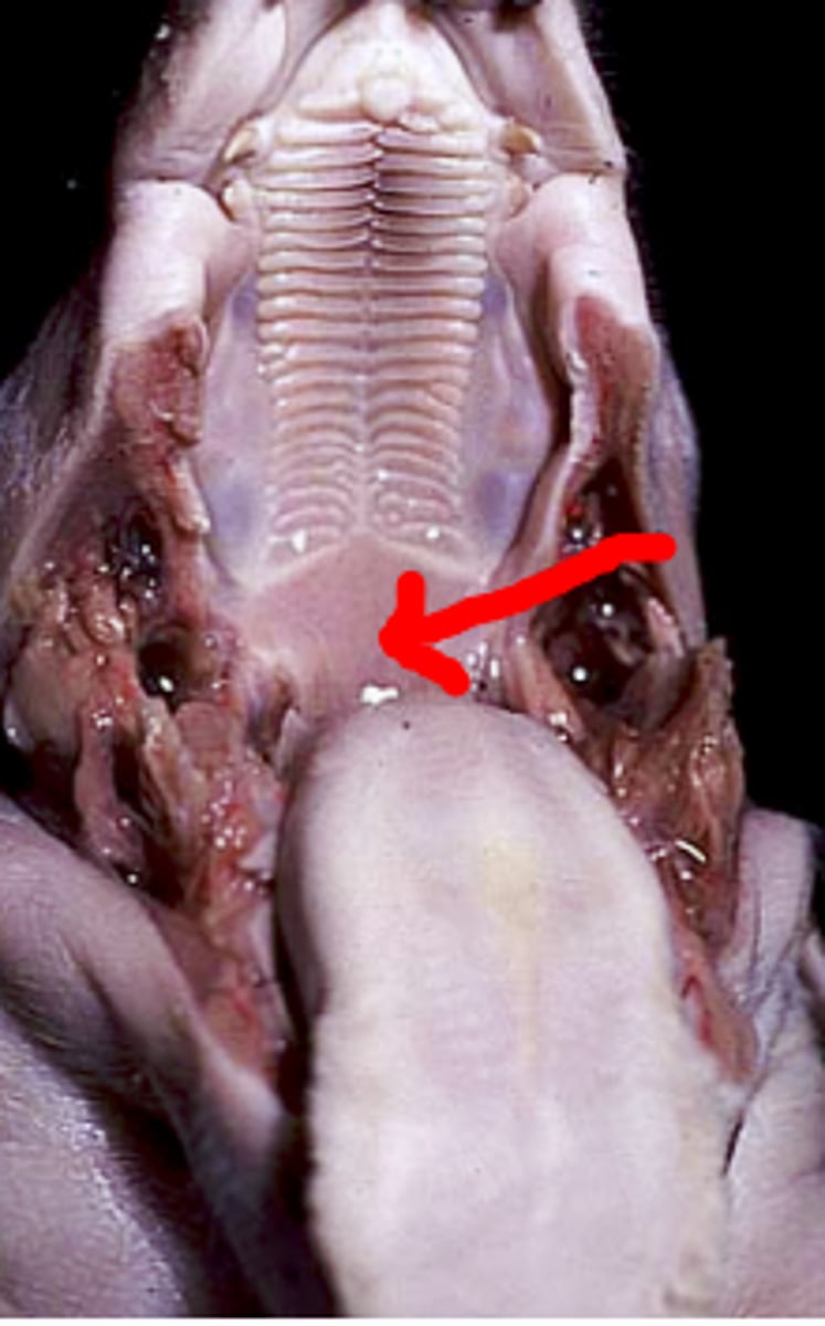 <p>a muscular flap that closes off the nasopharynx during swallowing or speaking</p>
