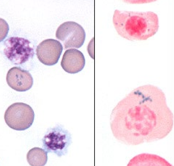 * contain blue/black aggregates
* Stain blue w Prussian blue stain
* More centralized
* Iron excess
* causes : Lead poisoning, Hemolytic anemia, Dyserythropoiesis, Myeloproliferative dz: effect bone marrow production of RCs, Some drugs (chloramphenicol, hydroxyzine in dogs)