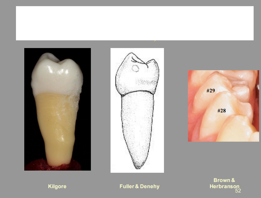 <p>From the Picture Shown, What Tooth Is This, And What View?</p>