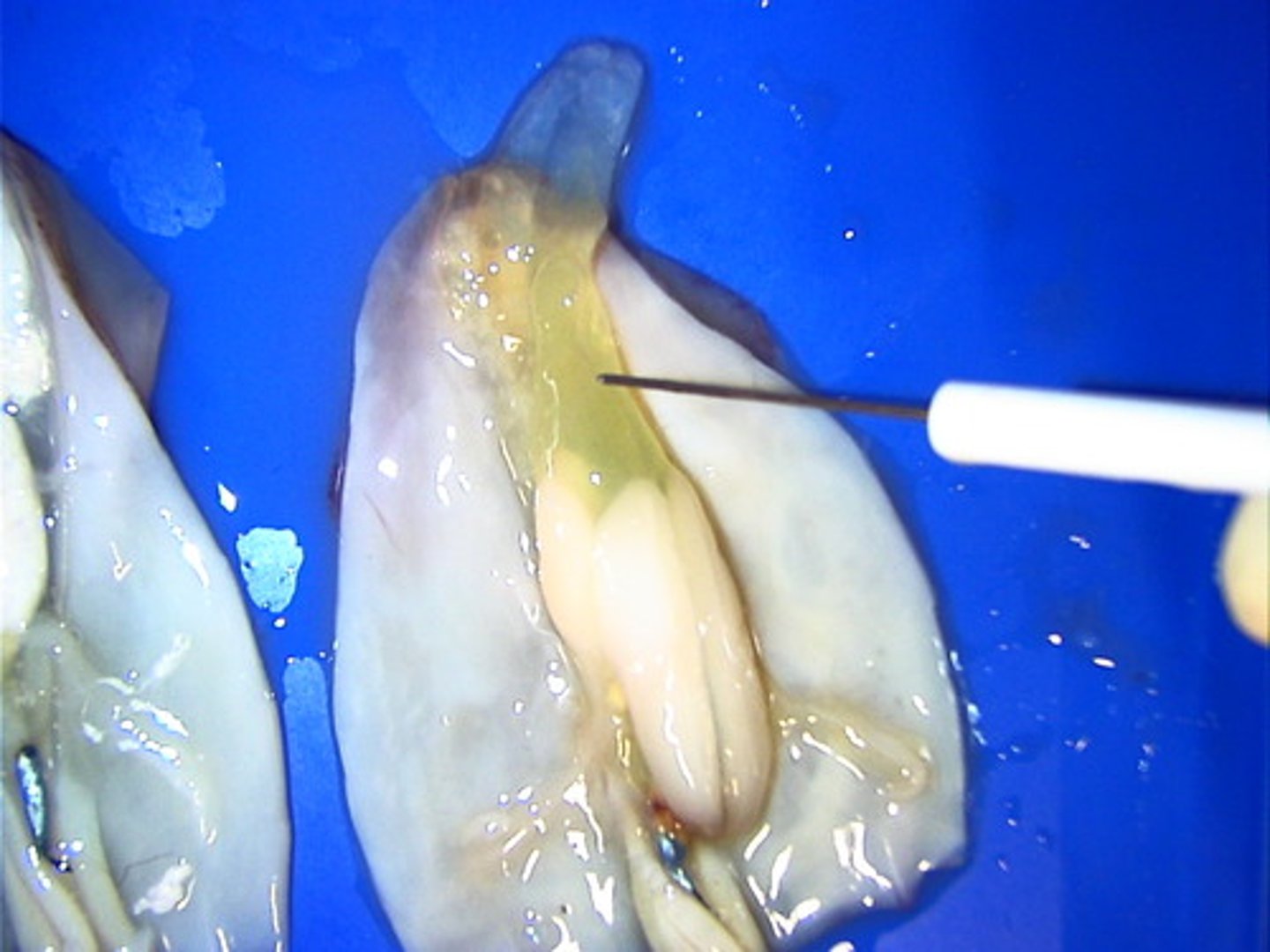 <p>This is the reproductive organ. It is white in males, clear in females.</p>
