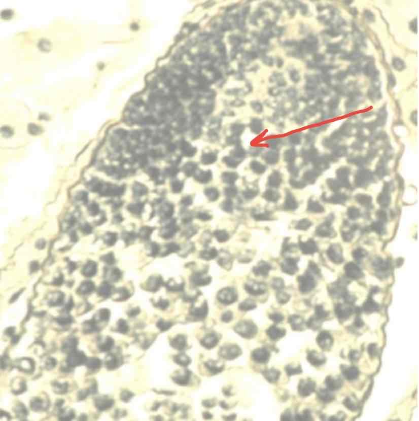 <p>What does the following image depict? Provide name, ploidy number and location</p>