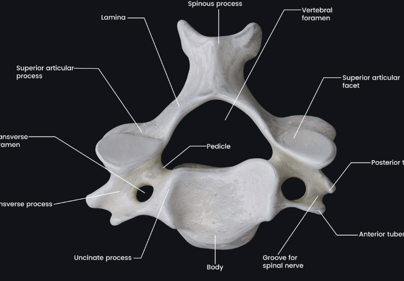 <p>Name this Vertebra</p>