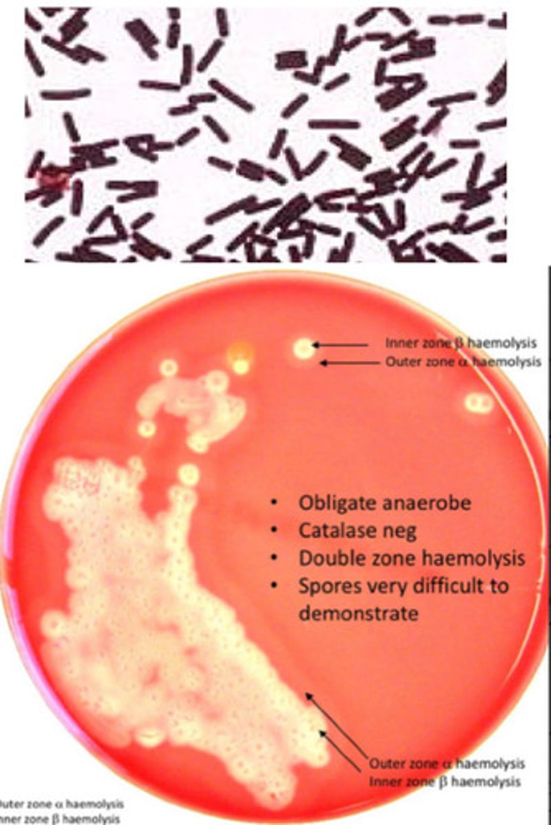 <p>GPB, catalase neg, AnO2 @ 48hrs, double zone haemolysis, obligate anaerobe = sensitive to MTZ, brick shaped, causes gas gangrene</p>
