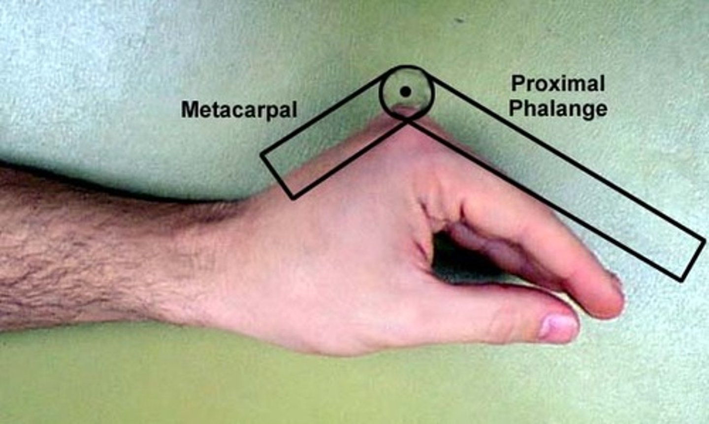 <p>fulcrum: dorsal MCP joint<br>proximal: dorsal midline of metacarpal<br>distal: dorsal midline of proximal phalanx<br><br>* medial/ulnar side of hand resting on table<br>* normal value = 90</p>