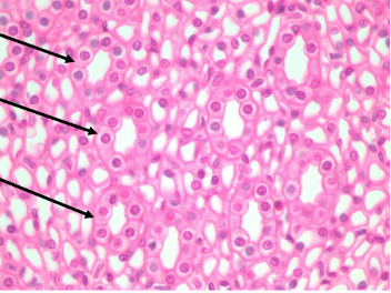 <p>What type of tissue is this?</p>