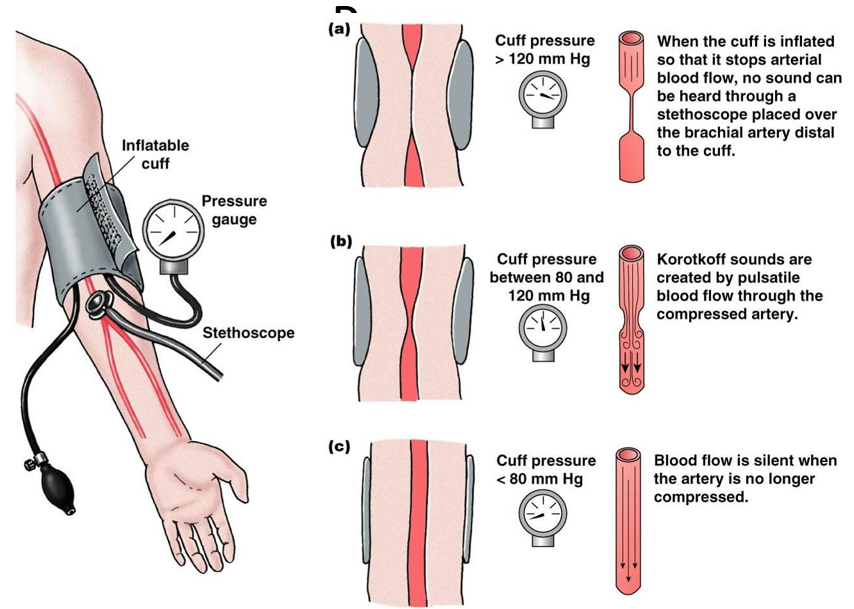 <p><strong>blood pressure cuff</strong>: increase pressure to collapse artery</p><ul><li><p><u>greater than 120</u>: no sound, artery is collapsed (decrease until hear sound = systolic pressure)</p></li><li><p><u>between 80 and 120</u>: Korotkoff sounds (decrease until no sound = diastolic pressure)</p></li><li><p><u>below 80</u>: no sound, regular blood flow</p></li></ul>