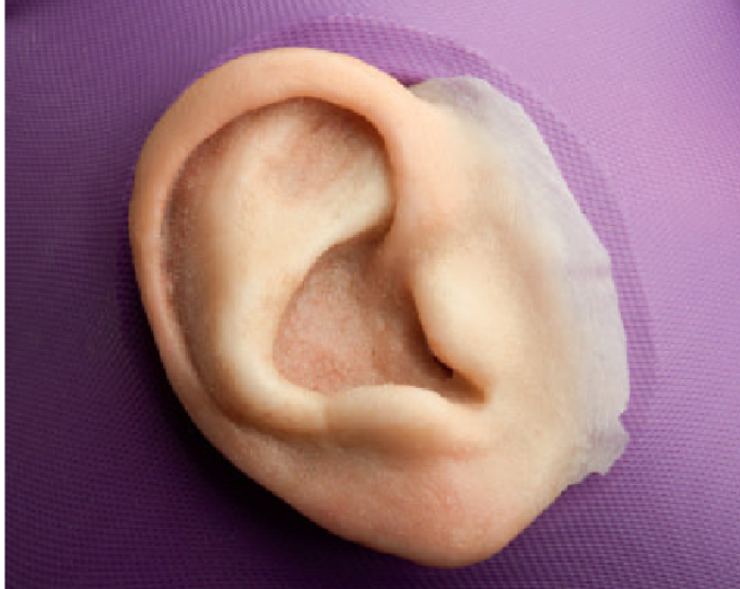 <ul><li><p>can mimic the presence of missing structures and provide personal and emotional comfort for the patient and gives them confidence not to be socially rejected because of the presence of his physical defect </p></li></ul><p></p>