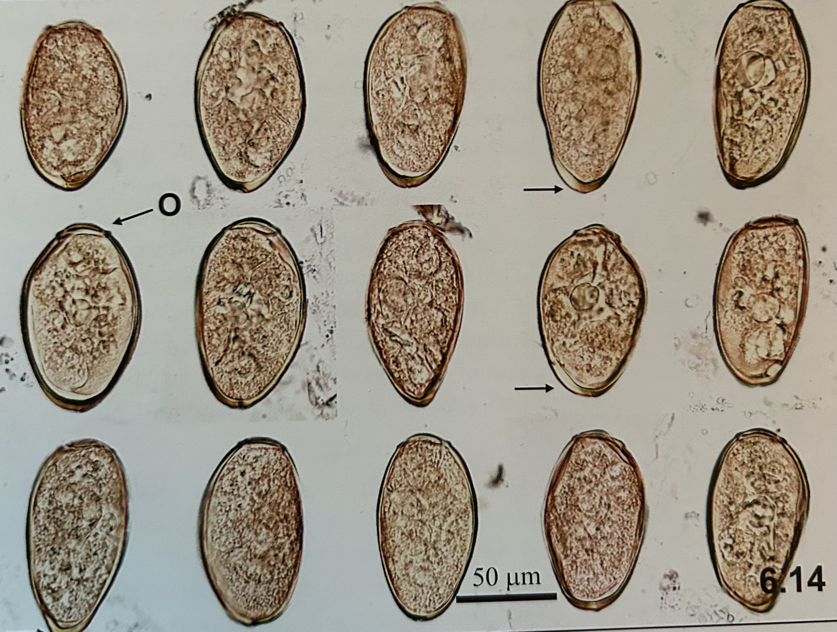 <p>structures of Paragonimus westernmani (egg)?</p>